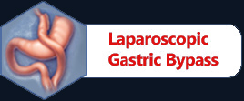 Laparoscopic Gastric Bypass